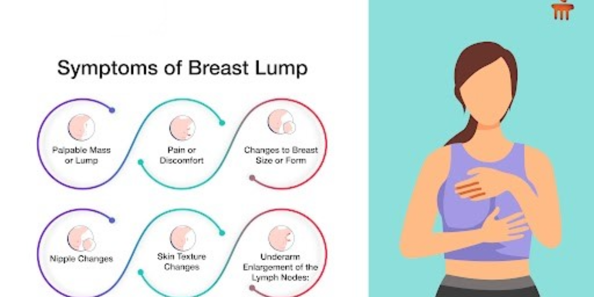 Understanding Benign Breast Lumps: Why Early Evaluation Matters for Young Females